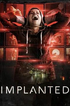 Cấy Ghép Bí Ẩn